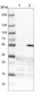 Zinc Finger And BTB Domain Containing 49 antibody, NBP1-92628, Novus Biologicals, Western Blot image 