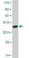 Toll Like Receptor 8 antibody, H00051311-M01, Novus Biologicals, Western Blot image 