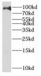 Enhancer Of Zeste 1 Polycomb Repressive Complex 2 Subunit antibody, FNab02917, FineTest, Western Blot image 