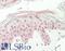 MDS1 And EVI1 Complex Locus antibody, LS-B14027, Lifespan Biosciences, Immunohistochemistry paraffin image 