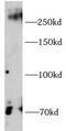 Chondroitin Sulfate Proteoglycan 4 antibody, FNab10522, FineTest, Western Blot image 