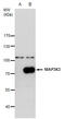 Mitogen-Activated Protein Kinase Kinase Kinase 3 antibody, GTX111498, GeneTex, Western Blot image 