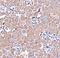 Cyclin Dependent Kinase Inhibitor 1C antibody, A01244-2, Boster Biological Technology, Immunohistochemistry paraffin image 