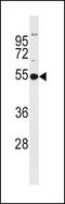 Glutathione Synthetase antibody, GTX81665, GeneTex, Western Blot image 