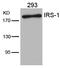 Insulin Receptor Substrate 1 antibody, GTX50550, GeneTex, Western Blot image 