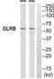 Glycine Receptor Beta antibody, TA313930, Origene, Western Blot image 