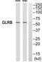 Glycine Receptor Beta antibody, TA313930, Origene, Western Blot image 