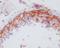 Integrin Subunit Beta 3 antibody, M00587-1, Boster Biological Technology, Immunohistochemistry paraffin image 