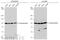 Karyopherin Subunit Beta 1 antibody, GTX133733, GeneTex, Western Blot image 