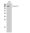 Ataxin 2 Like antibody, A08149, Boster Biological Technology, Western Blot image 