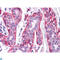 Fyn Related Src Family Tyrosine Kinase antibody, LS-C814075, Lifespan Biosciences, Immunohistochemistry paraffin image 