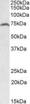 Regulatory Factor X5 antibody, EB10082, Everest Biotech, Western Blot image 