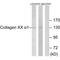 Collagen Type XX Alpha 1 Chain antibody, MBS9402992, MyBioSource, Western Blot image 
