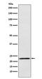 Prolactin antibody, M00601-2, Boster Biological Technology, Western Blot image 