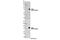 Engulfment and cell motility protein 1 antibody, 14457S, Cell Signaling Technology, Western Blot image 