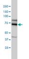 Ecdysoneless Cell Cycle Regulator antibody, H00011319-M01, Novus Biologicals, Western Blot image 