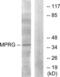 Progestin And AdipoQ Receptor Family Member 5 antibody, LS-C120742, Lifespan Biosciences, Western Blot image 
