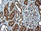 Sterol Carrier Protein 2 antibody, M02947, Boster Biological Technology, Immunohistochemistry paraffin image 