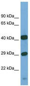 SGSH antibody, TA346526, Origene, Western Blot image 