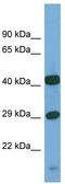 N-Sulfoglucosamine Sulfohydrolase antibody, TA346526, Origene, Western Blot image 