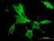 P21 (RAC1) Activated Kinase 3 antibody, H00005063-M08, Novus Biologicals, Immunocytochemistry image 