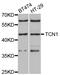 TCI antibody, abx004908, Abbexa, Western Blot image 