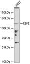 Eukaryotic Translation Elongation Factor 2 antibody, 13-032, ProSci, Western Blot image 