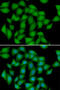 Antioxidant 1 Copper Chaperone antibody, abx005237, Abbexa, Western Blot image 