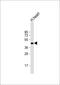 Nuclear Factor I B antibody, 59-180, ProSci, Western Blot image 