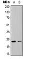 Ubiquitin Domain Containing 1 antibody, LS-C354207, Lifespan Biosciences, Western Blot image 
