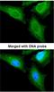 Calcium/Calmodulin Dependent Protein Kinase Kinase 2 antibody, NBP1-31247, Novus Biologicals, Immunofluorescence image 