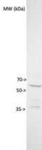 Transmembrane Protein 87B antibody, NBP1-94006, Novus Biologicals, Western Blot image 