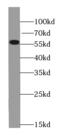 Leucine Rich Repeat Protein 1 antibody, FNab04851, FineTest, Western Blot image 