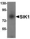 Salt Inducible Kinase 1 antibody, A04399, Boster Biological Technology, Western Blot image 