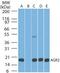 Anterior Gradient 2, Protein Disulphide Isomerase Family Member antibody, MA5-16244, Invitrogen Antibodies, Western Blot image 