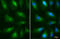 Presenilin 1 antibody, GTX116016, GeneTex, Immunocytochemistry image 