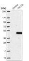 THO Complex 3 antibody, NBP1-92501, Novus Biologicals, Western Blot image 