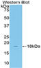 Solute Carrier Family 12 Member 3 antibody, LS-C292487, Lifespan Biosciences, Western Blot image 