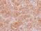 NFKB Inhibitor Interacting Ras Like 2 antibody, NBP2-19545, Novus Biologicals, Immunohistochemistry frozen image 
