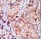 Tribbles Pseudokinase 3 antibody, LS-C100924, Lifespan Biosciences, Immunohistochemistry paraffin image 