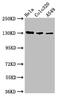 Integrin Subunit Alpha V antibody, CSB-PA011877LA01HU, Cusabio, Western Blot image 