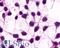 Glutamate Metabotropic Receptor 3 antibody, LS-A3218, Lifespan Biosciences, Immunocytochemistry image 