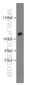 Prospero Homeobox 1 antibody, 19554-1-AP, Proteintech Group, Western Blot image 