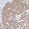 Ribosomal Protein L5 antibody, NBP2-22285, Novus Biologicals, Immunohistochemistry paraffin image 