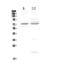 CHM Rab Escort Protein antibody, PA5-79043, Invitrogen Antibodies, Western Blot image 