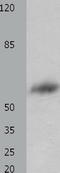 KIAA1041 antibody, TA322362, Origene, Western Blot image 