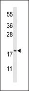 Cofilin 1 antibody, MBS9205122, MyBioSource, Western Blot image 