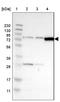 Chloride Voltage-Gated Channel 2 antibody, NBP1-85585, Novus Biologicals, Western Blot image 