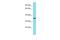 AMMECR1 Like antibody, A18240, Boster Biological Technology, Western Blot image 