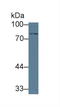 Transforming Growth Factor Beta Receptor 2 antibody, LS-C373074, Lifespan Biosciences, Western Blot image 